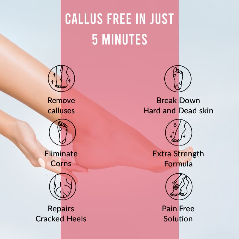 Professional Callus Remover for Feet – 8 Oz, Original, Powerful Formulation – Extra Strength Gel, Works in 5 Min , Home Pedicure Foot Spa Results – Cracked &amp; Dead Dry Skin Supplies thumbnail 4