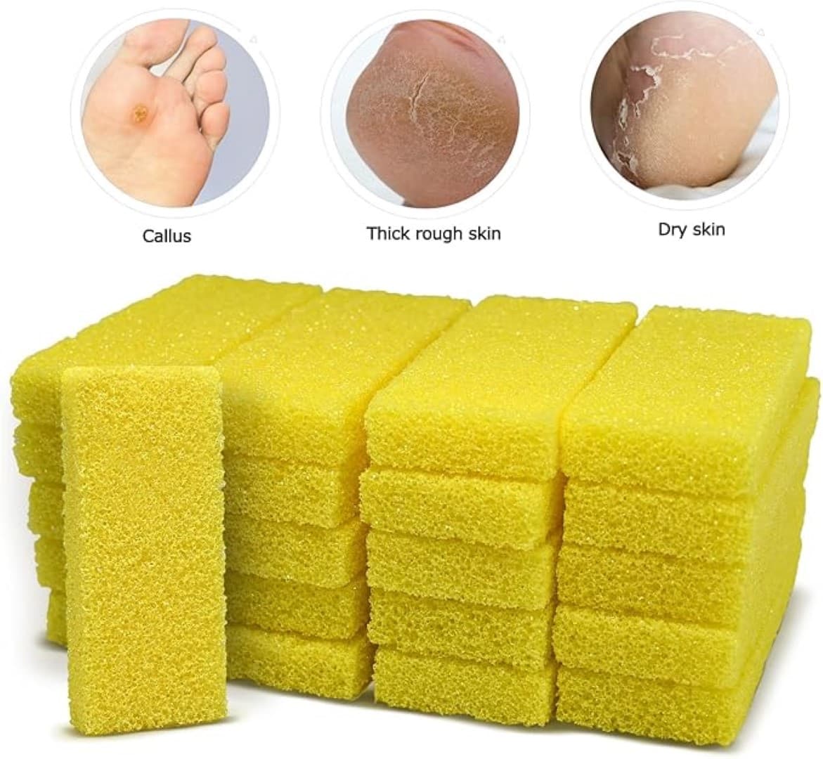Disposable Foot Scrubber Sponge Pads – Pedicure Pumice Stone for Feet, Callus Remover, Medium Coarse – Yellow (40 Pcs) – Portable At-Home or Travel Foot Care thumbnail 4